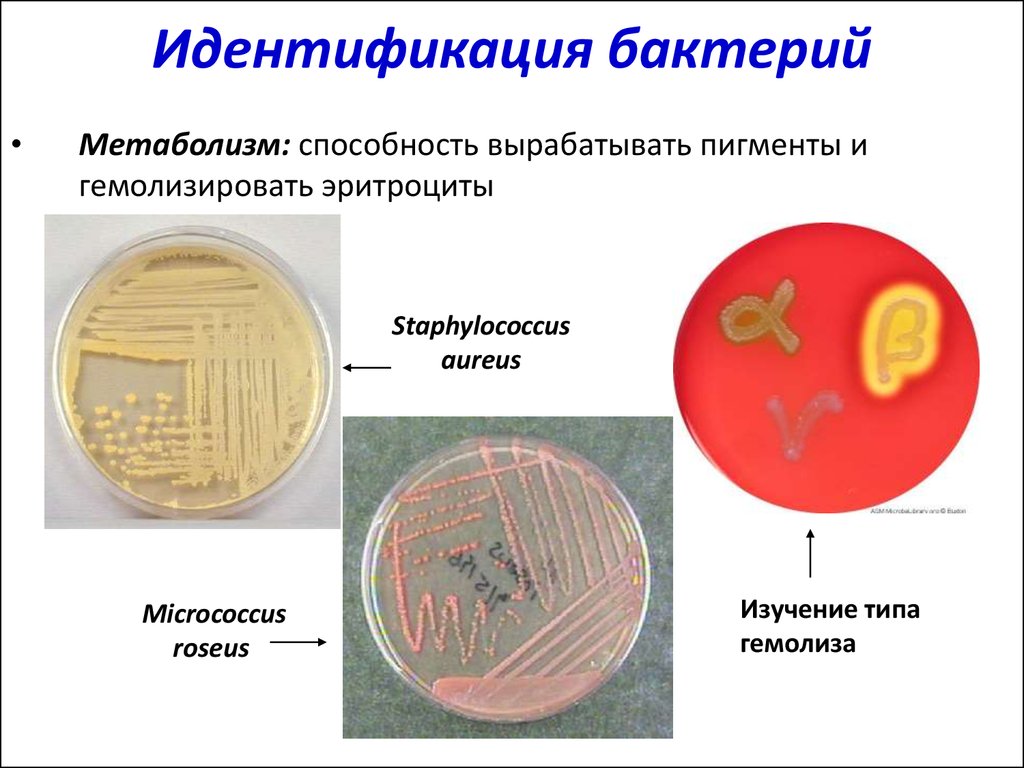 Свойства идентификации бактерий. Методы идентификации микроорганизмов. Биохимическая идентификация микроорганизмов. Идентификация стафилококка. Выявление s. aureus.