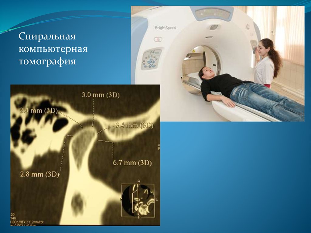 Спиральная компьютерная томография. Спиральная компьютерная томография (СКТ).. Спираль на кт. Подготовка к СКТ.