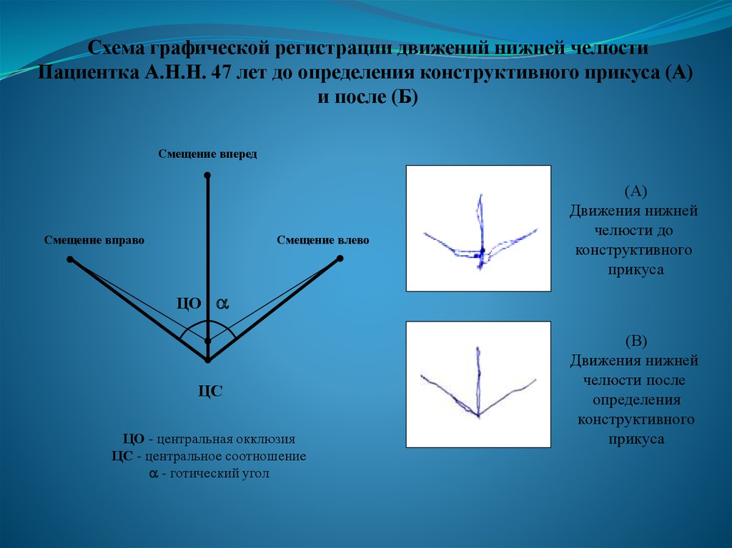 Готический угол