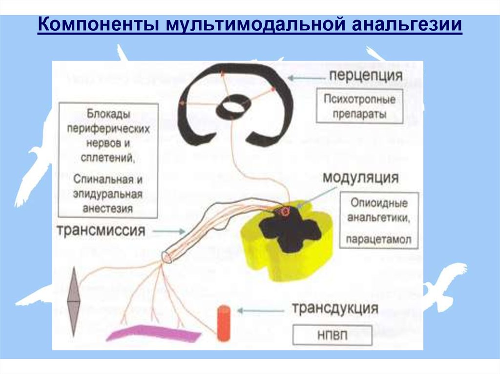 Мультимодальная анестезия презентация