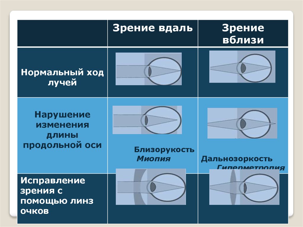 Какая из схем хода лучей в глазу человека соответствует