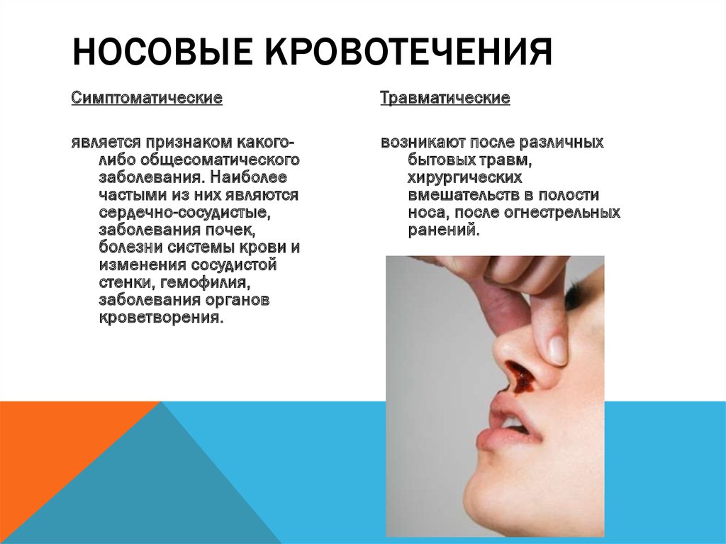 Кровотечение из носа у мужчин. Нососовое кровотечение. Причины носового кровотечения. Носок кровотечение причины.