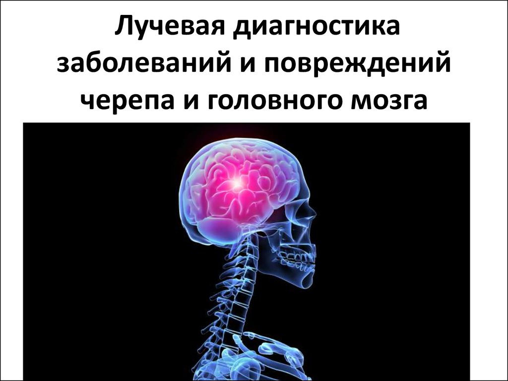 Заболевания головного и спинного мозга. Лучевая диагностика заболеваний головного мозга. Рентгенодиагностика заболеваний головного мозга. Лучевая диагностика черепа. Лучевые методы исследования головного мозга.