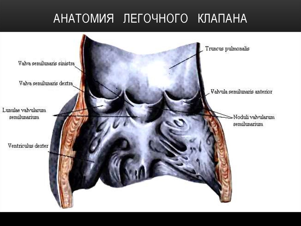 Полулунные клапаны легочной артерии