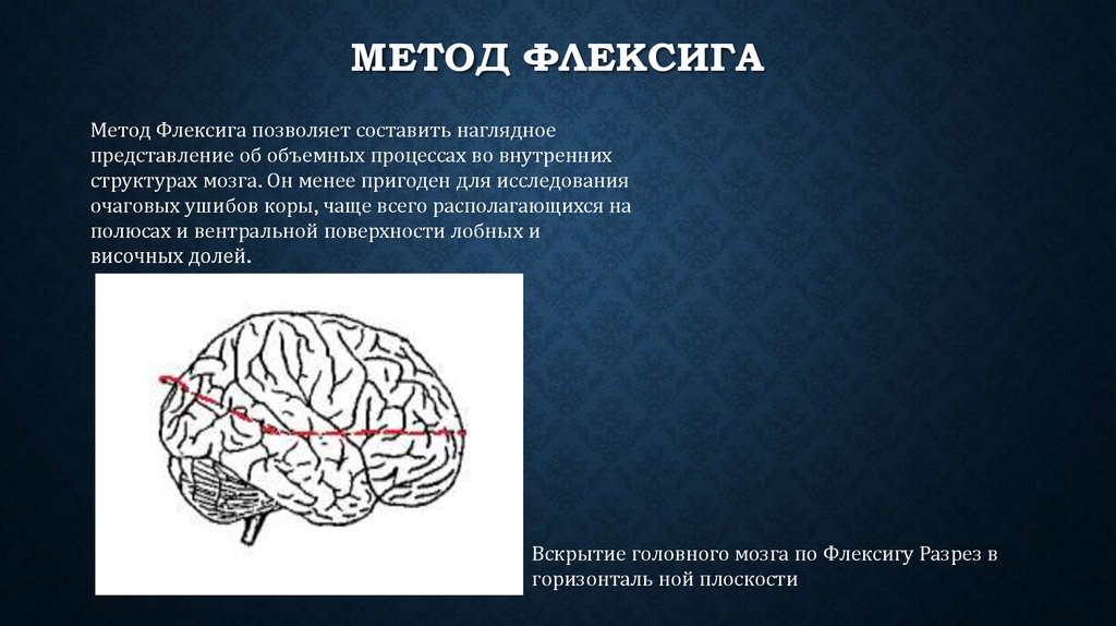 Метод мозга. Исследование мозга метод Флексига. Метод вскрытия головного мозга. Вскрытие головного мозга по Флексигу.