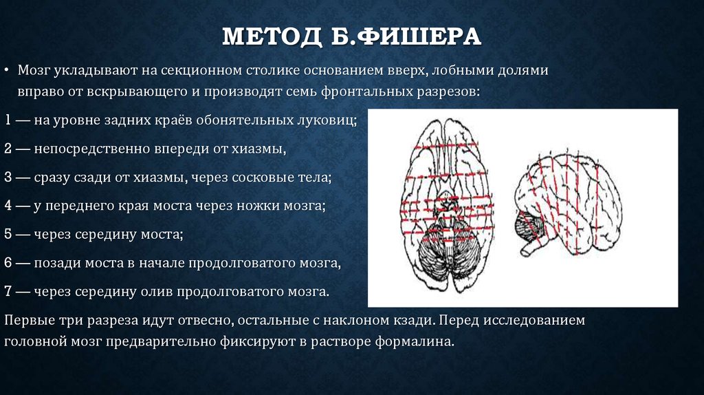 Метод фишера. Вскрытие мозга по Фишеру. Метод исследования головного мозга по Фишеру. Методики вскрытия головного мозга. Метод вскрытия головного мозга по Фишеру.