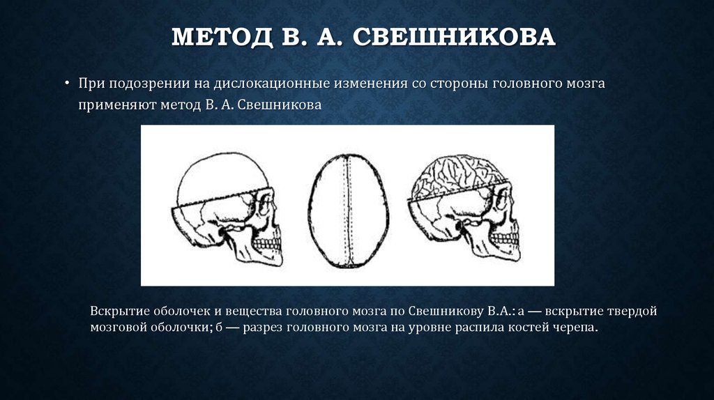 Получение головной. Методы вскрытия черепа. Извлечение головного мозга. Вскрытие головного мозга. Вскрытие черепа человека.