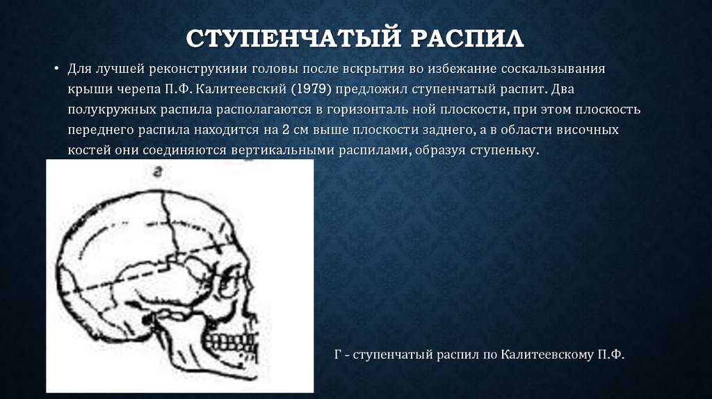 Ступенчатый распил