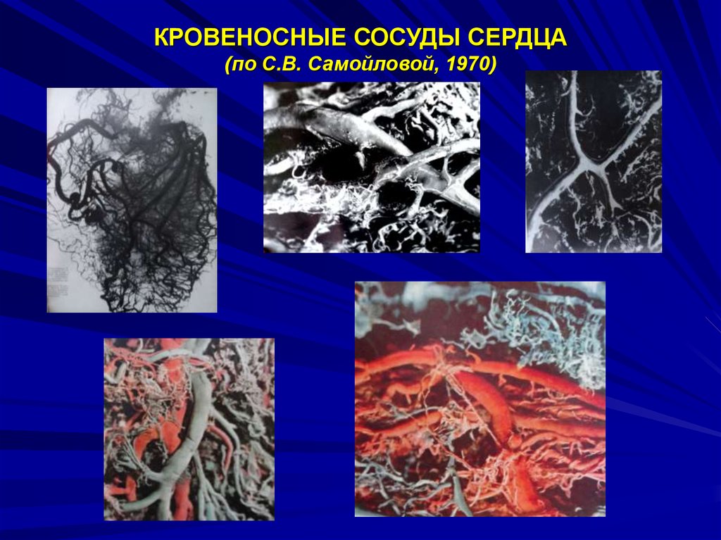 КРОВЕНОСНЫЕ СОСУДЫ СЕРДЦА (по С.В. Самойловой, 1970)