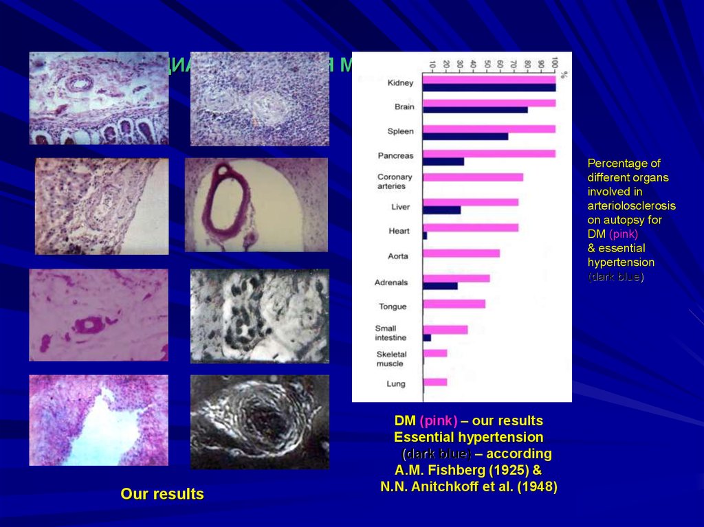 ДИАБЕТИЧЕСКАЯ МИКРОАНГИОПАТИЯ