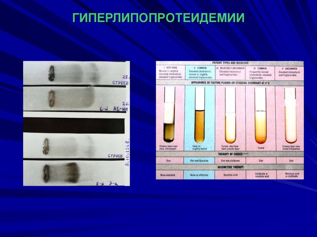 ГИПЕРЛИПОПРОТЕИДЕМИИ