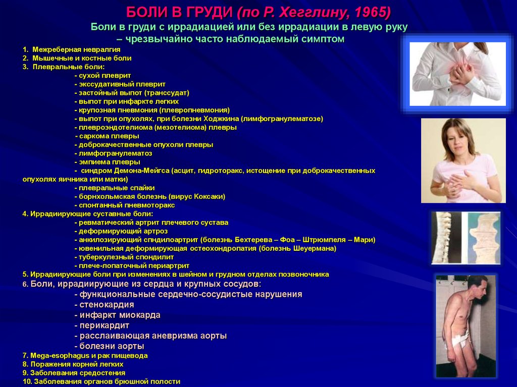 БОЛИ В ГРУДИ (по Р. Хегглину, 1965)