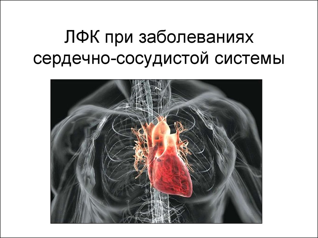 ЛФК при заболеваниях сердечно-сосудистой системы - презентация онлайн