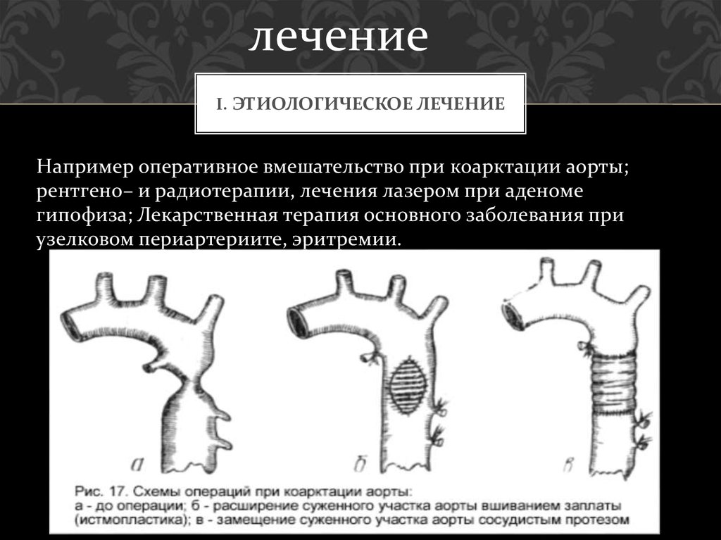I. Этиологическое лечение