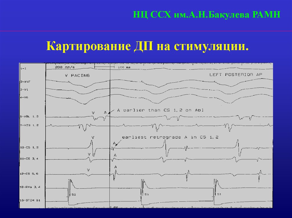 Диагностические варианты. Диаграмма сердечно сосудистая хирургия. Сердечно-сосудистой хирургия экс. Отчеты по сердечно-сосудистой хирургии. Топикотопико диагностические варианты центрального параоича.