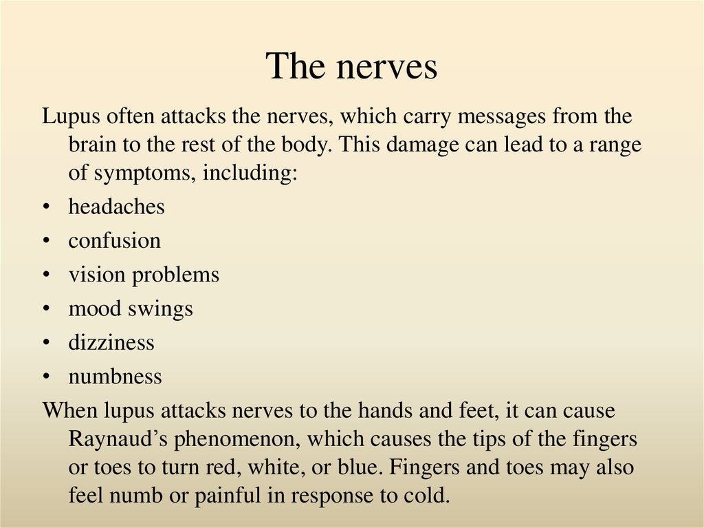 Systemic Lupus Erythematosus Sle Online Presentation