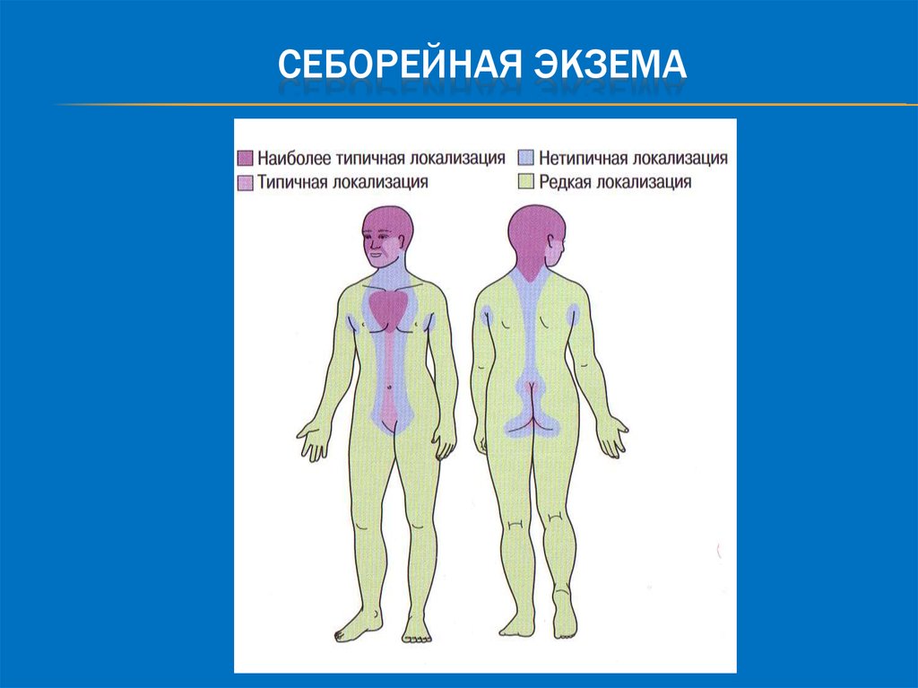 Экзема дерматовенерология презентация