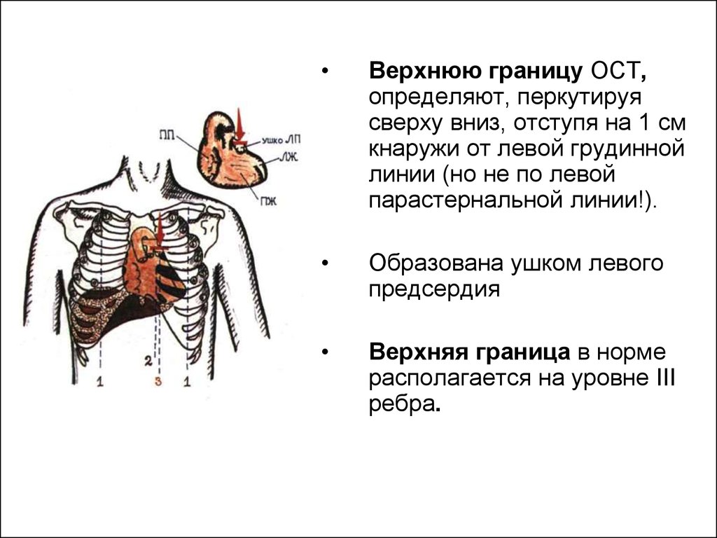 Верхняя граница. Перкуссия верхней границы сердца. Границы относительной сердечной тупости в норме пропедевтика. Сосудистый пучок сердца пропедевтика. Расширение верхней границы ОСТ.