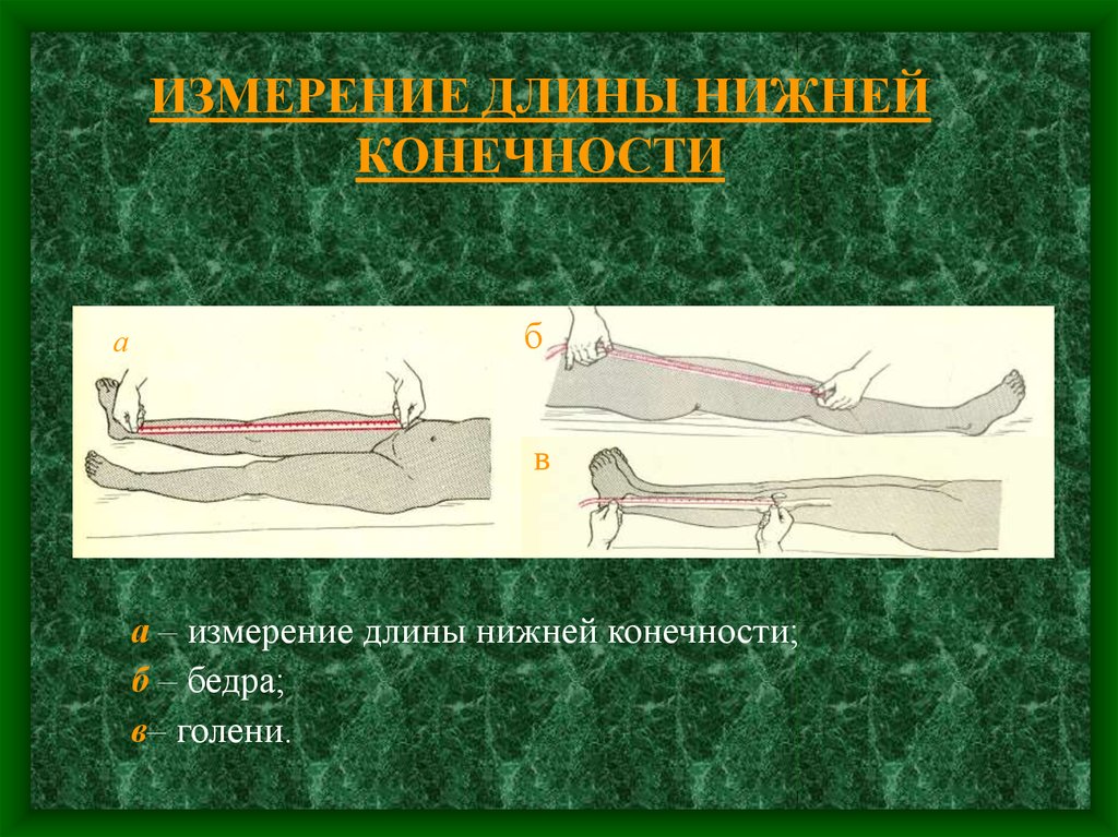 Функциональная длина. Измерения нижойконечности. Измерение нижней конечности. Измерение длины верхней конечности травматология. Измерение абсолютной и относительной длины конечности.