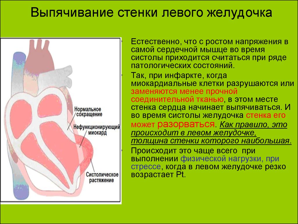 Изменения боковых отделов. Базальные отделы желудочков сердца. Гипокинез стенок левого желудочка. Задняя стенка левого желудочка. Гипокинезия стенок левого желудочка.