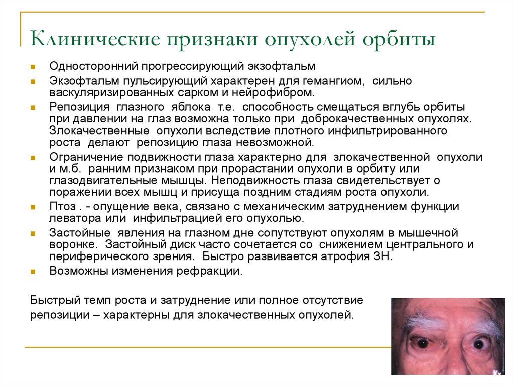 Клинические признаки опухолей орбиты