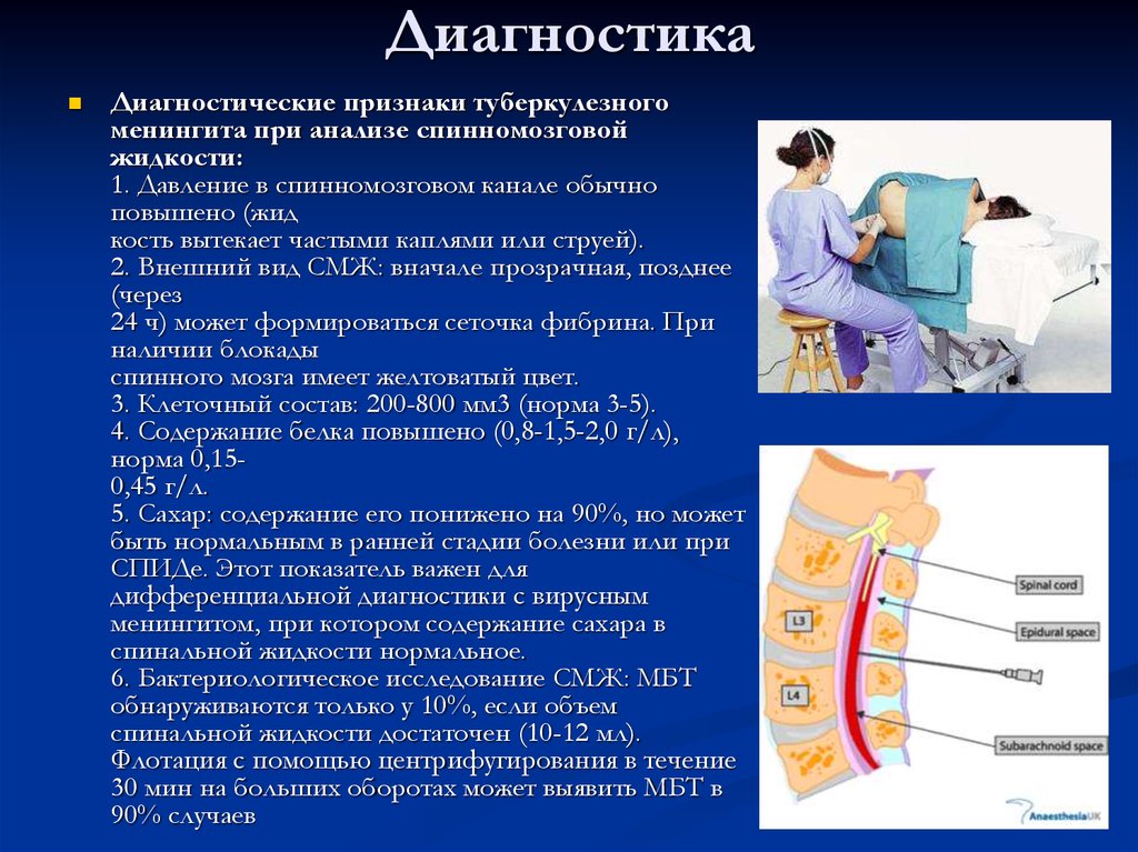 Туберкулезный менингит презентация