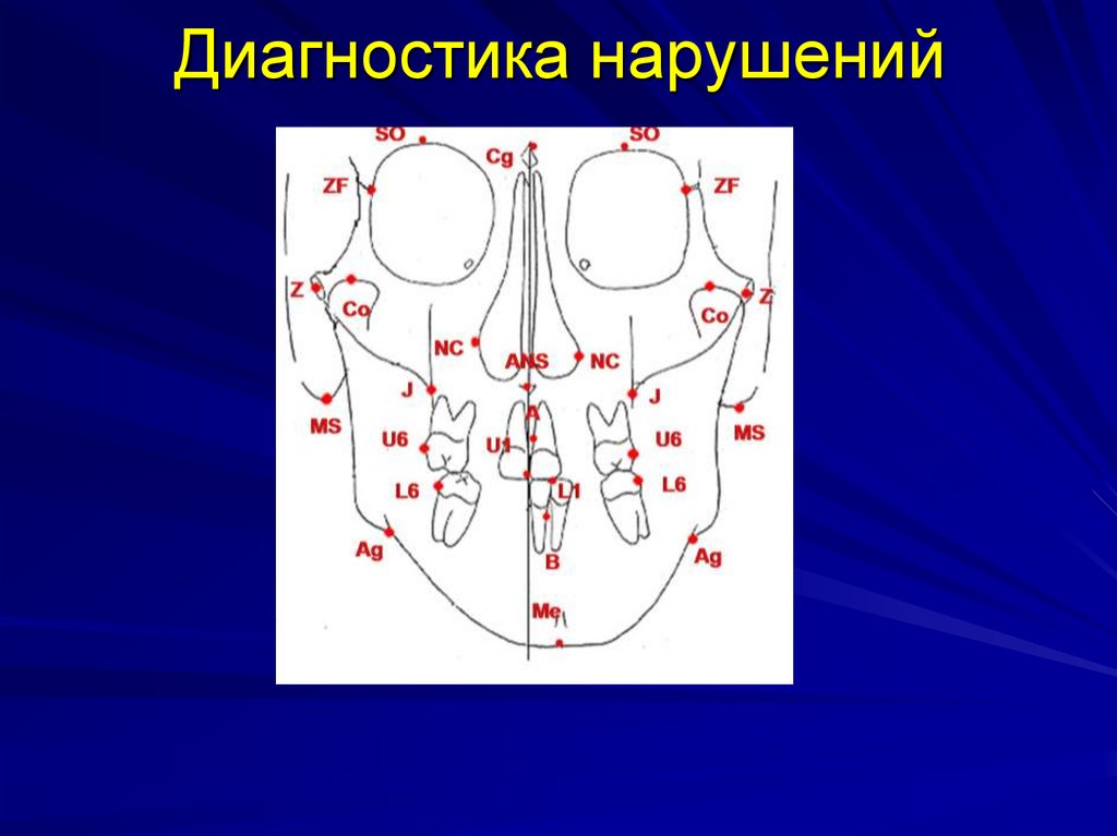 Диагностика нарушений