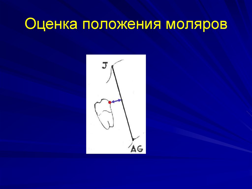 Оценить положение. Оценка положения. Референтная плоскость это. Передняя лицевая референтная плоскость. Лицевая референтная плоскость.