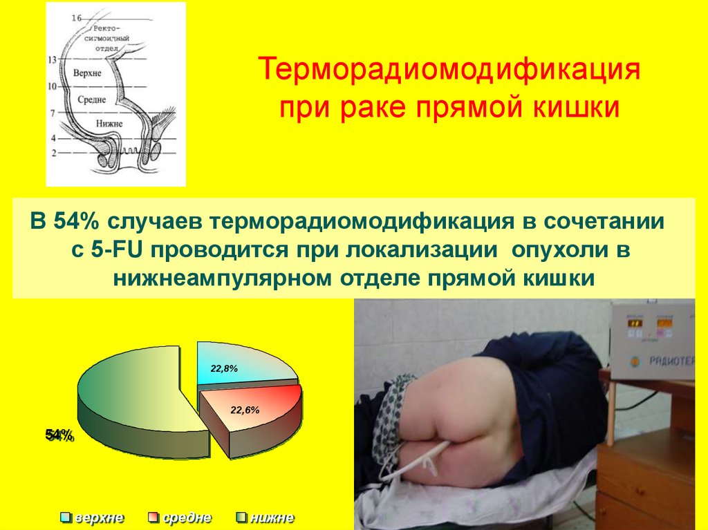 Температура при раке. Радиорезистентность опухоли это. Радио резистентный опухоль. Радиочувствительные опухоли. Опухоль средней степени радиочувствительности.