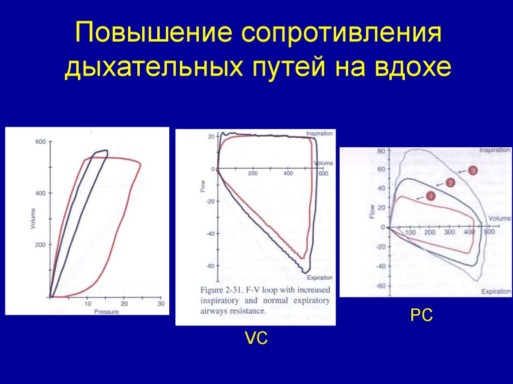 Повышение сопротивления. Увеличение сопротивления дыхательных путей. Повышенное сопротивление дыхательных путей. Увеличение сопротивления на вдохе. Причина увеличение сопротивления дыхательных путей.