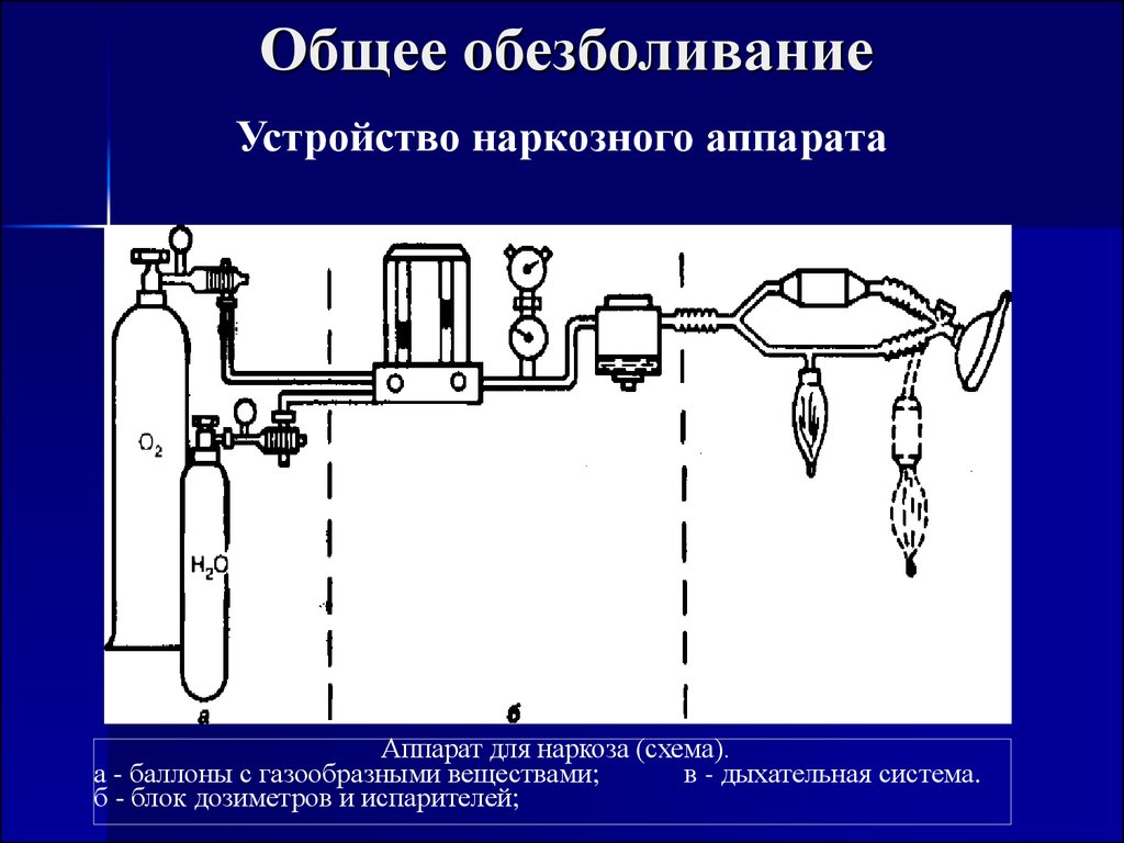 Устройство аппарата. Основные узлы наркозно-дыхательного аппарата. Схема наркозного аппарата основные узлы. Устройство аппарата для ингаляционного наркоза. Аппаратура для наркоза схема.