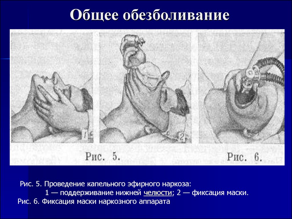 Общая анестезиология презентация