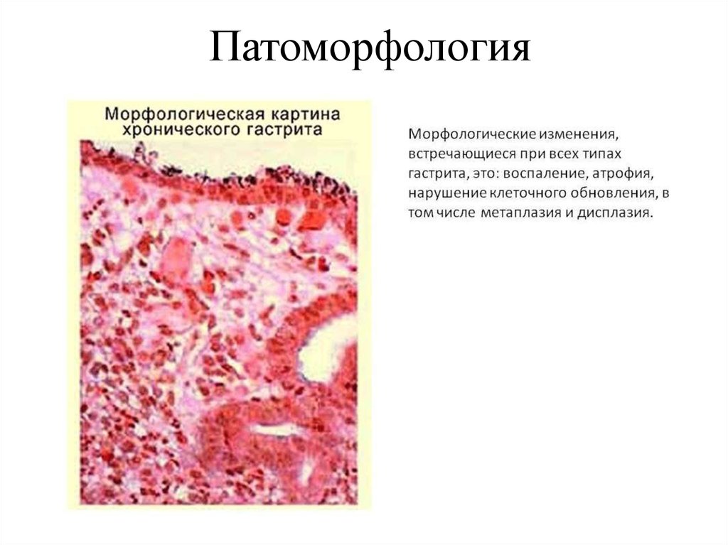 Морфологическая картина что это такое в медицине