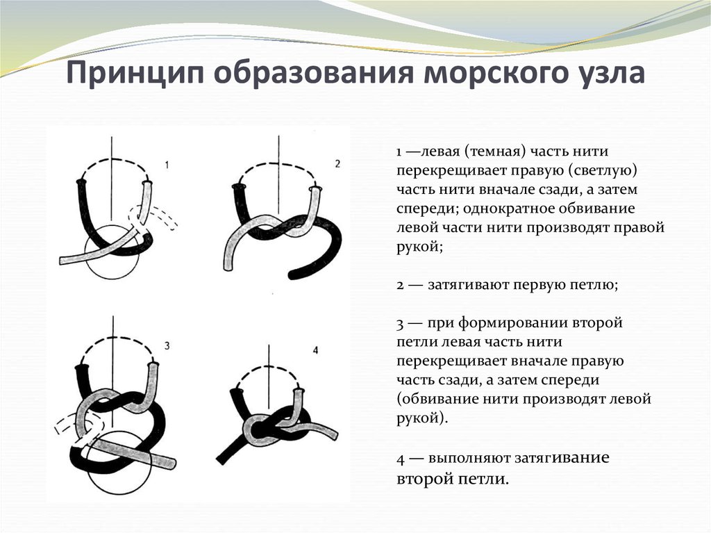 Кастрационная петля схема