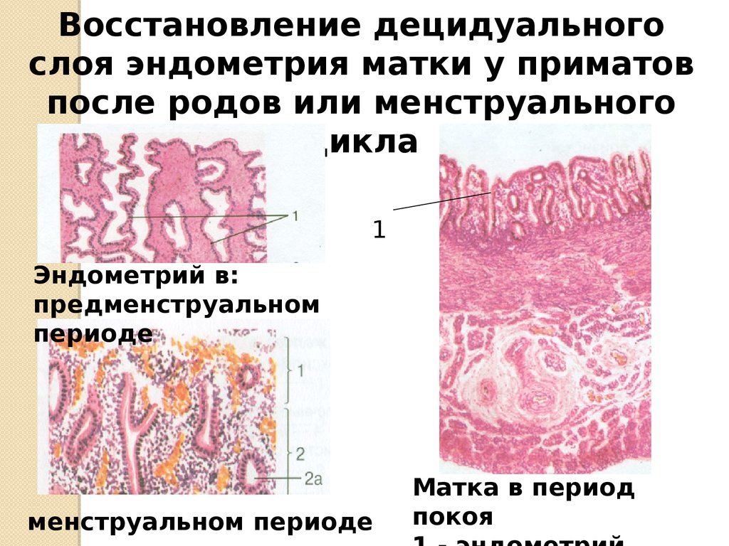 Фрагменты децидуальной ткани. Регенерация. Клеточная регенерация проявляется. Физиологическая и репаративная регенерация эпителиальных тканей.