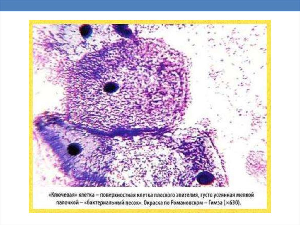 Ключевые клетки в мазке у женщин фото под микроскопом