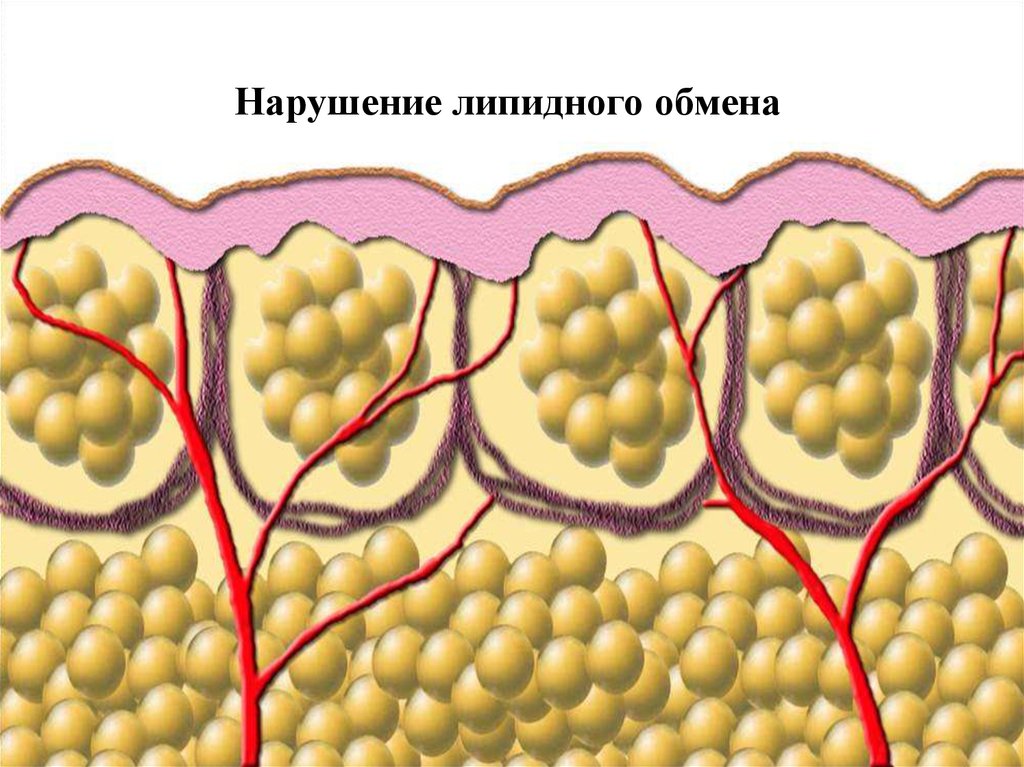 Нарушения липидного обмена заболевания. Нарушение обмена липидов. Патология липидного обмена. Расщепление жировых клеток. Нарушение метаболизма липидов.