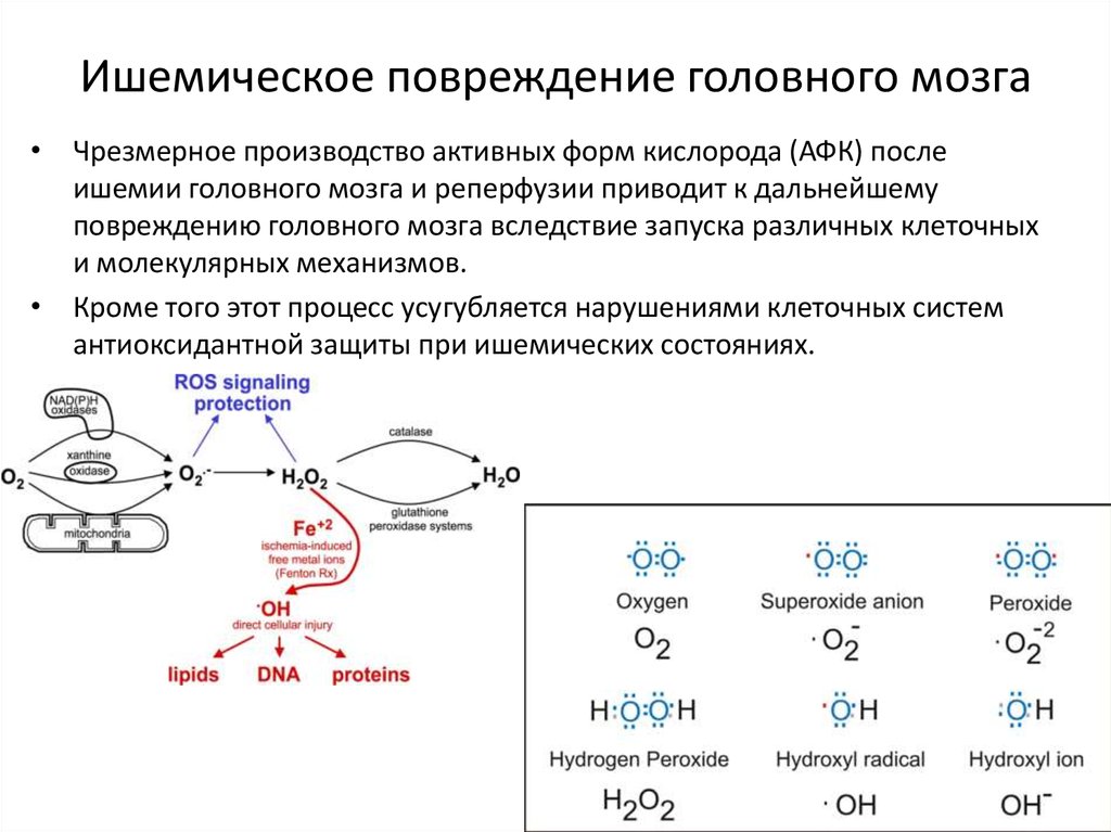 Ишемическое повреждение головного мозга