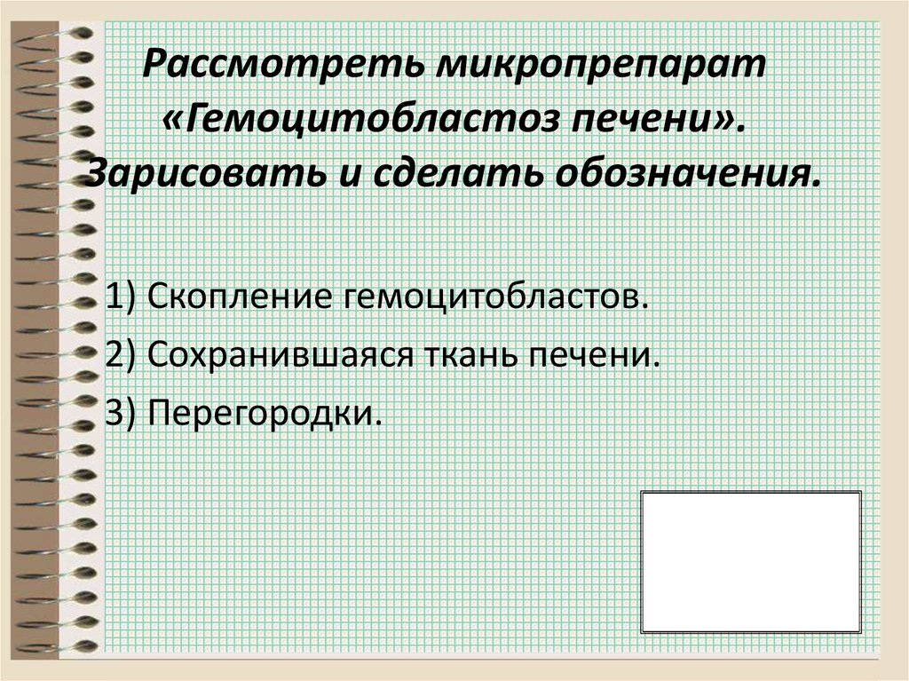 Рассмотреть микропрепарат «Гемоцитобластоз печени». Зарисовать и сделать обозначения.