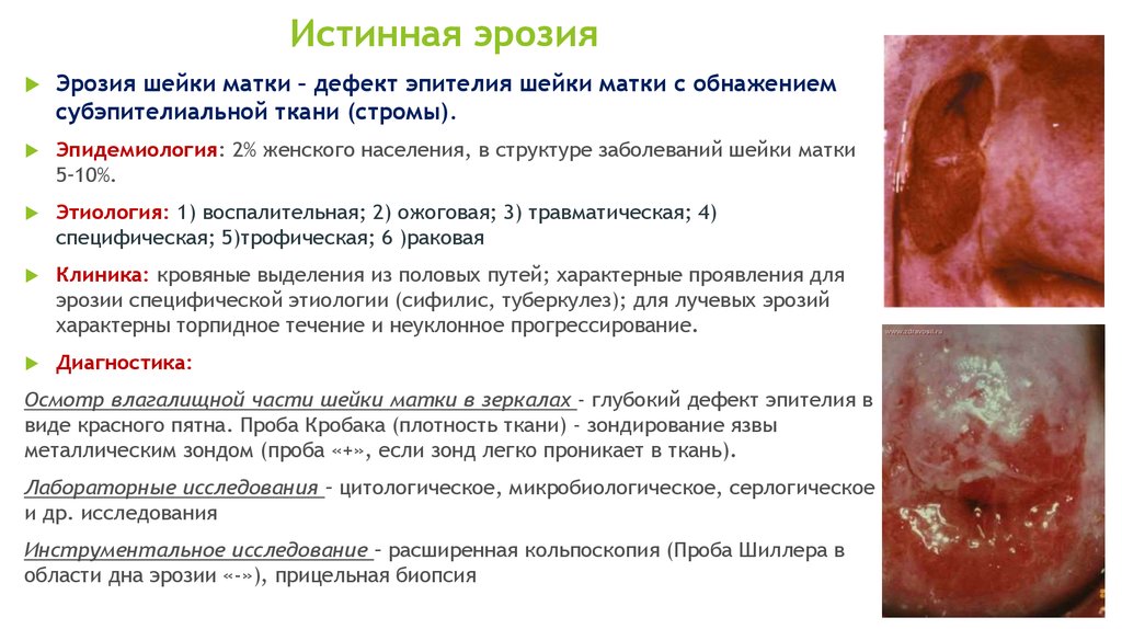 Реферат: Методы лечения доброкачественных и предраковых заболеваний шейки матки