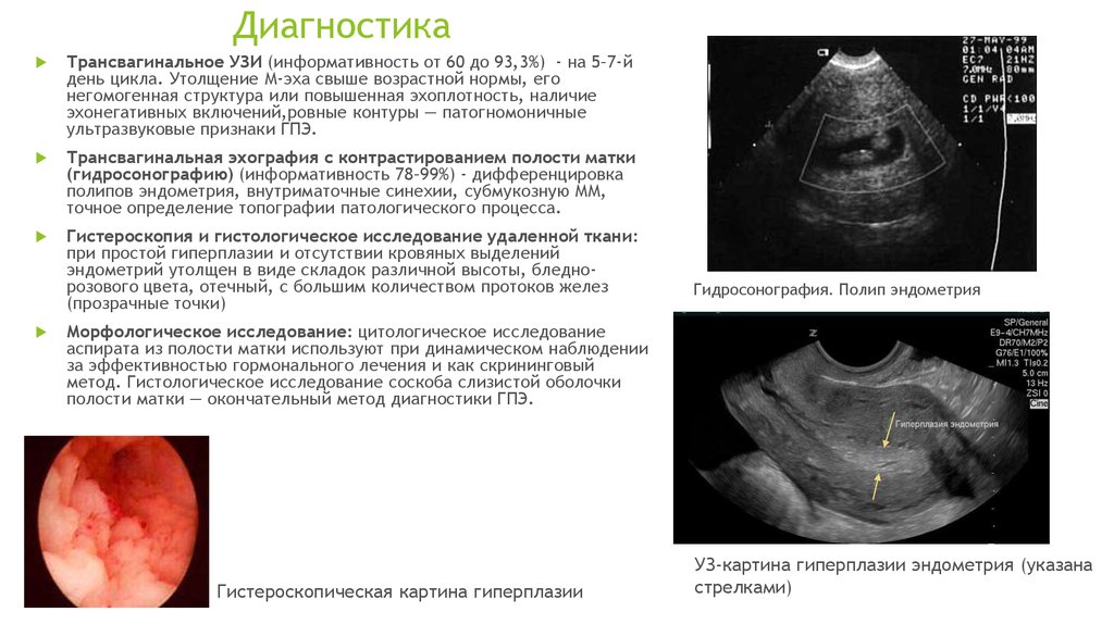 Эндометрий 7 5. Ультразвуковое исследование матки и придатков трансвагинальное. Трансвагинальное УЗИ полип эндометрия. Полип эндометрия на УЗИ 5 день цикла.