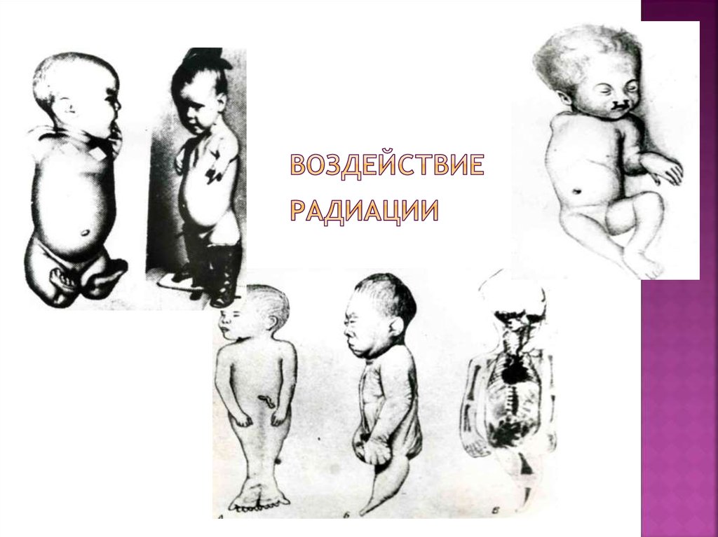 Воздействие радиации