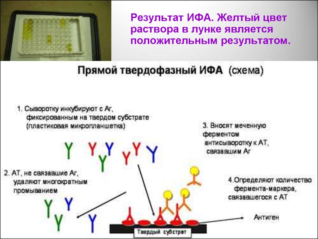 Тест метод ифа. Схему протекания твердофазного ИФА для серодиагностики. Реакция иммуноферментного анализа (ИФА).. Иммуноферментный анализ прямой и непрямой. Схема твердофазной ИФА.