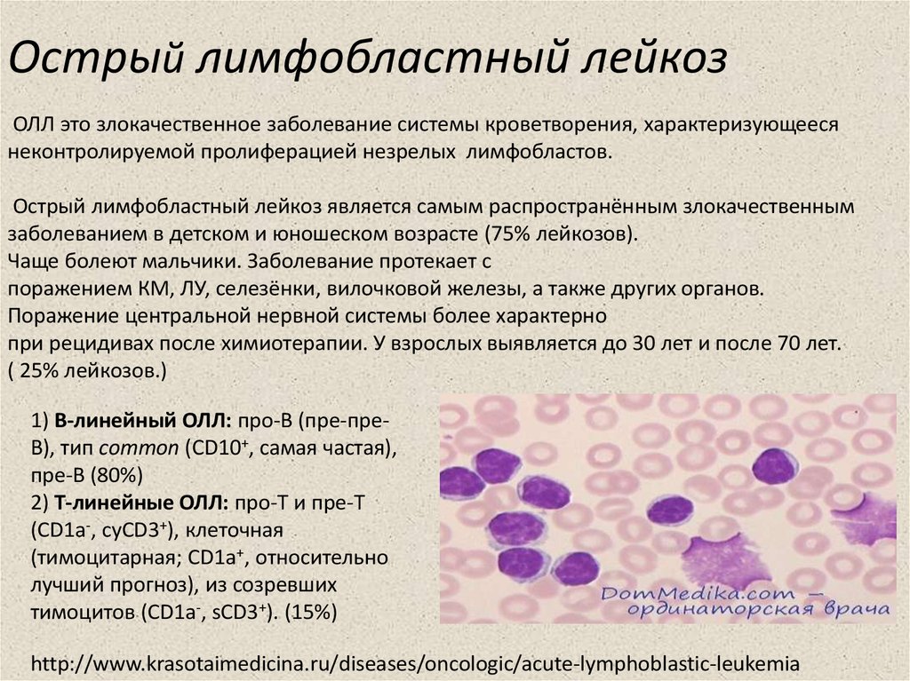 Что такое аденохром. Острый лимфобластный лейкоз в2 иммунный. Острый лимфобластный лейкоз миелограмма. 1. Острый лимфобластный лейкоз. Лимфобластный лейкоз цитохимические показатели.
