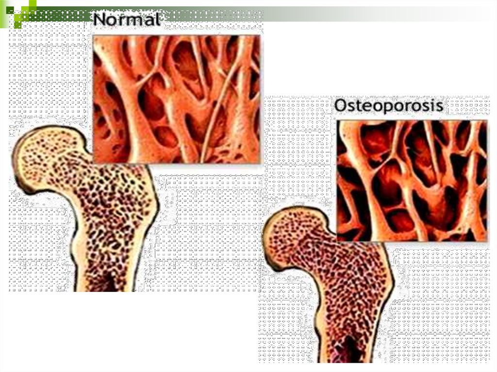 Костная болезнь. Болезни костей животных презентация. Биология заболевание костей. Заболевания костей примеры.