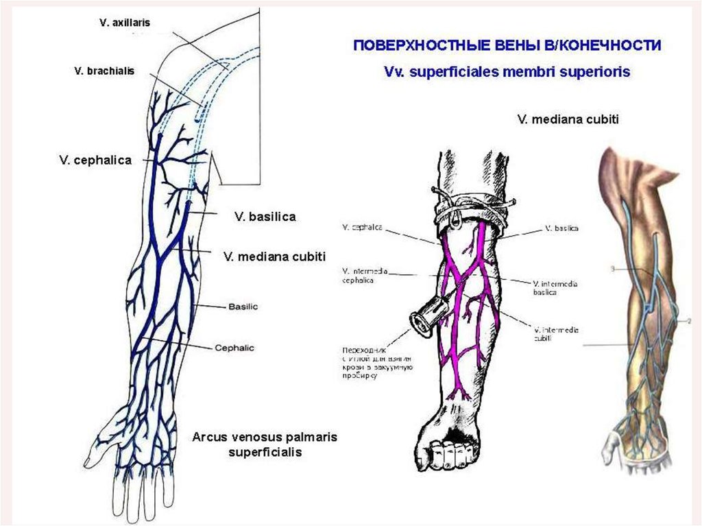 Вени 4. Cephalica Вена.