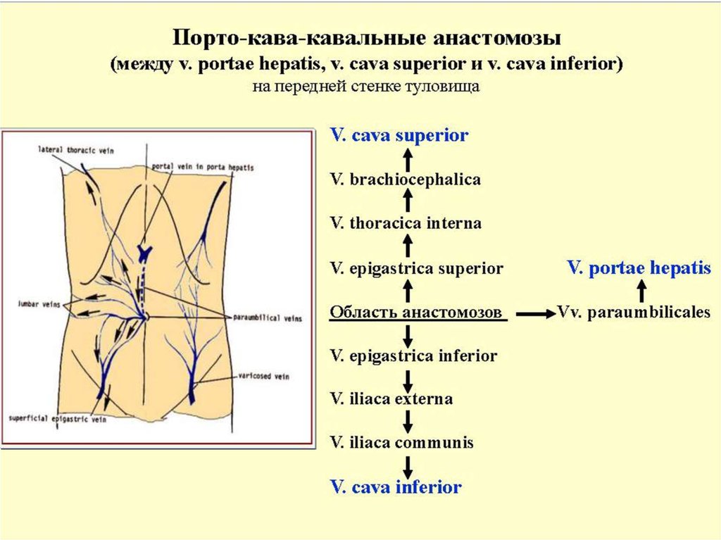 Порто кава. Порто кава кавальные анастомозы. Порто и кава кавальные анастомозы схема. Боковой кава кавальный анастомоз. К кава-кавальным анастомозам относится анастомоз:.