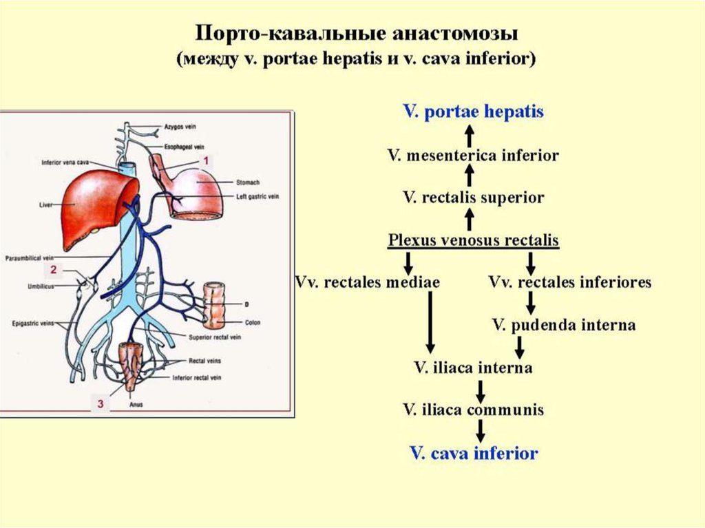 Порто кавальные и кава кавальные анастомозы. Порто и кава кавальные анастомозы схема. Порто-кава-кавальный анастомоз. Патологический Порто-кавальный шунт. Отток крови из прямокишечного венозного сплетения происходит в.