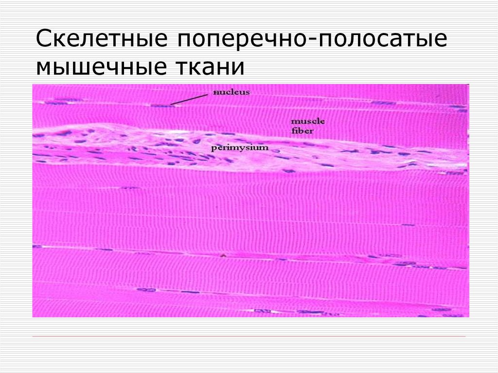 Поперечно полосатая скелетная ткань. Поперечно-полосатая Скелетная мышечная ткань. Скелетная мышечная ткань. Поперечнополосатая Скелетная мышечная тка. Клетки поперечно-полосатой мышечной ткани.