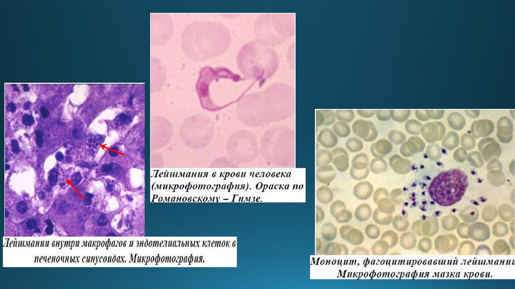 Строение лейшмания рисунок